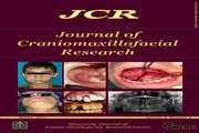 Efficacy of low level laser for prevention of pain and trismus after impacted mandibular third molar surgery